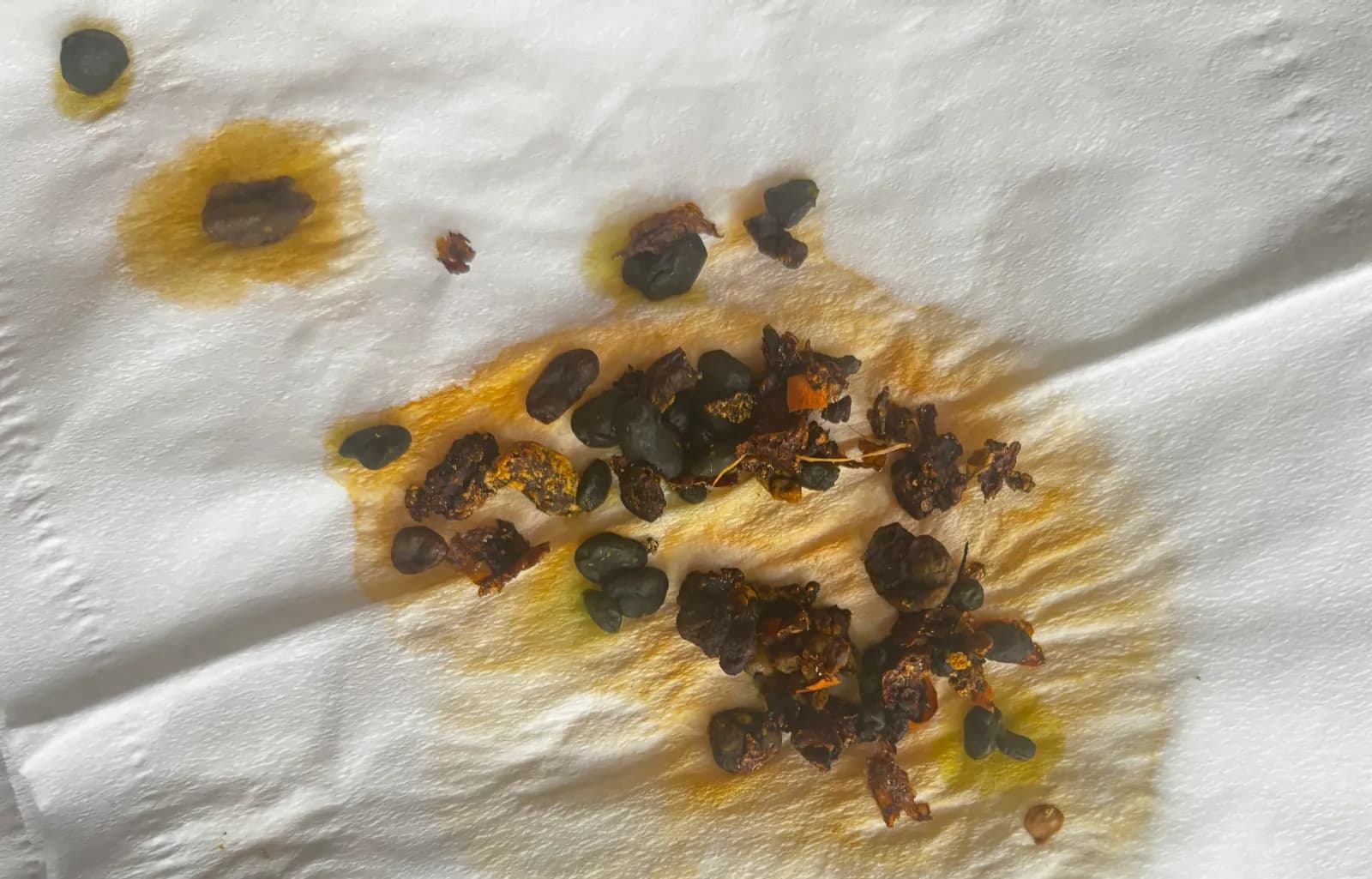 Green stones next to a coin for scale after a liver cleanse